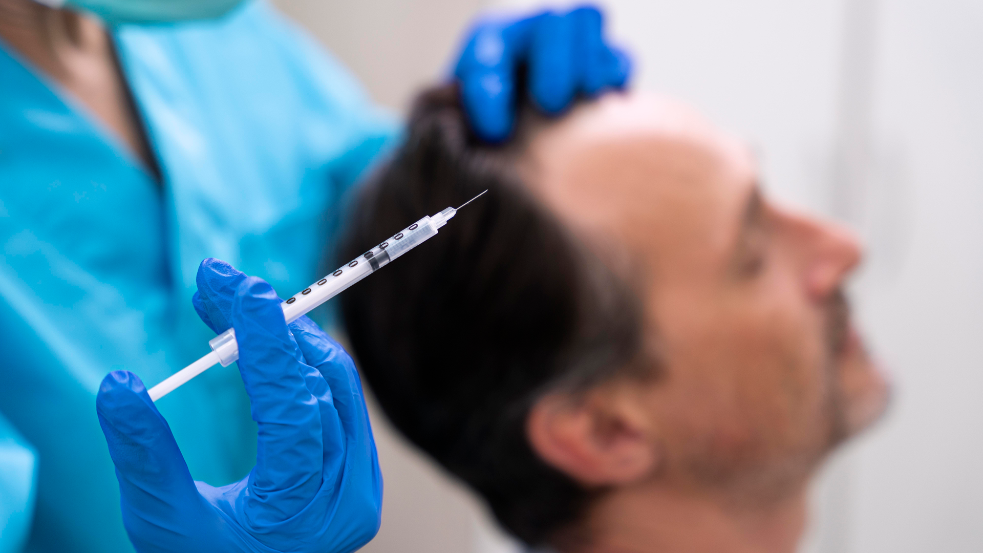 Hair Transplant-6
